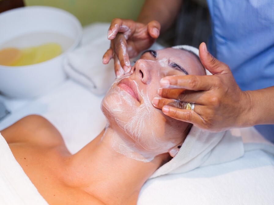 chemical-peels (1)
